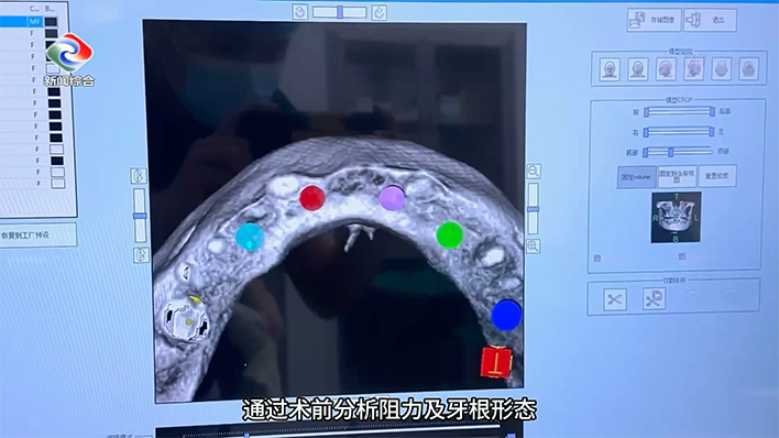 7.png