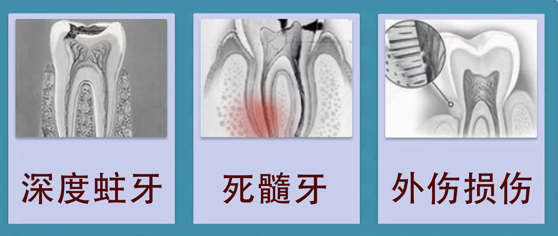 牙齿.jpg