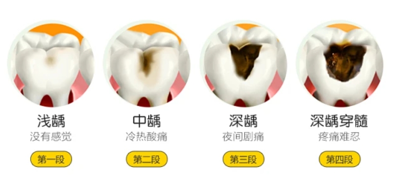 蛀牙.png