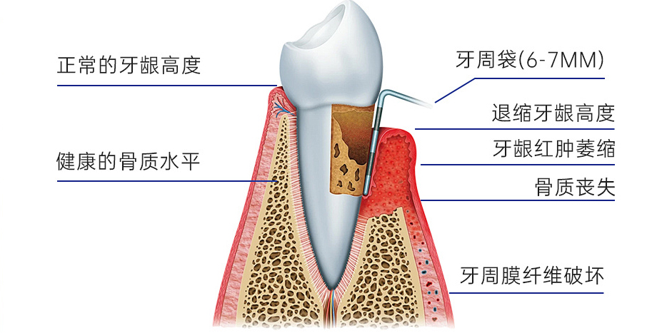 huaban-6483767713_03.jpg